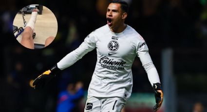 Luis Malagón muestra herida de la lesión que lo dejó fuera del Mundial 2026