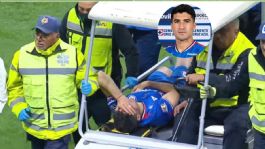 Foto que representa a Cruz Azul confirma la gravedad de la lesión de Nico Ibáñez; ¿cuánto tiempo estará fuera?