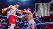 Foto ilustrativa de la nota titulada: Mario Bautista sufre fractura tras brutal KO de Aaron Mercury en Supernova Génesis 2026