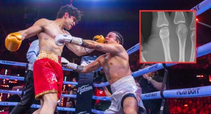 Mario Bautista sufre fractura tras brutal KO de Aaron Mercury en Supernova Génesis 2026