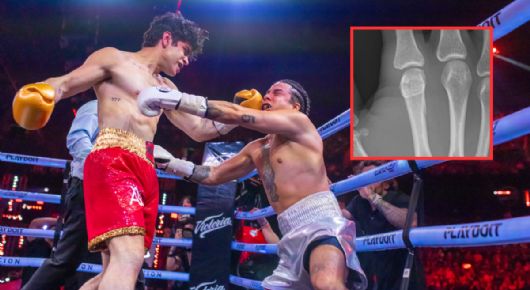Mario Bautista sufre fractura tras brutal KO de Aaron Mercury en Supernova Génesis 2026