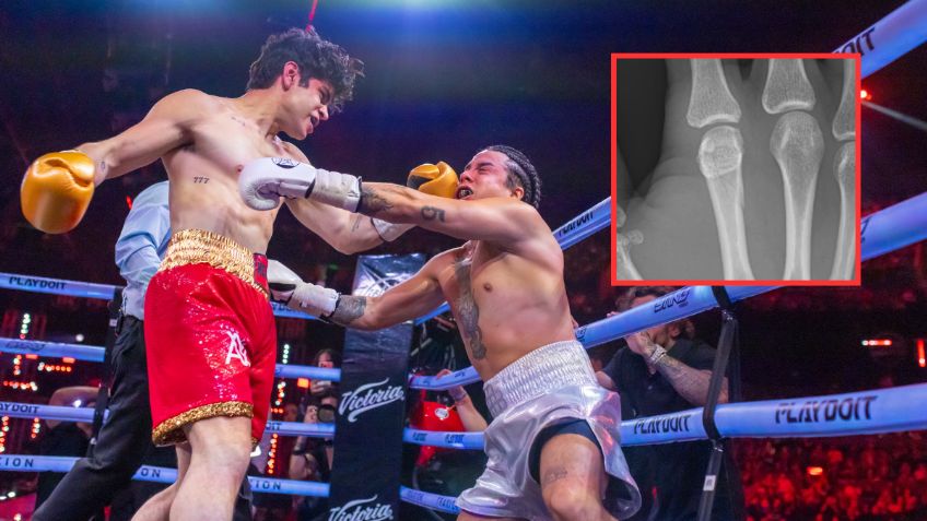 Mario Bautista sufre fractura tras brutal KO de Aaron Mercury en Supernova Génesis 2026